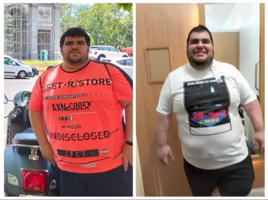 Álvaro antes e depois